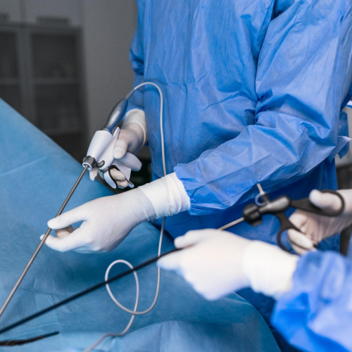 laparoscopy treatment